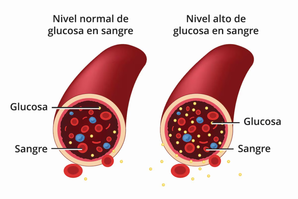 Cura de la diabetes tipo 1