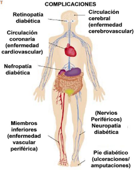 Diagnóstico de la diabetes tipo 1