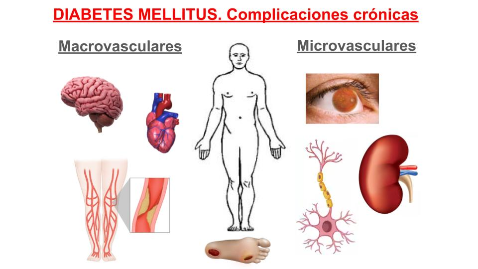 Tipos de complicaciones de la diabetes
