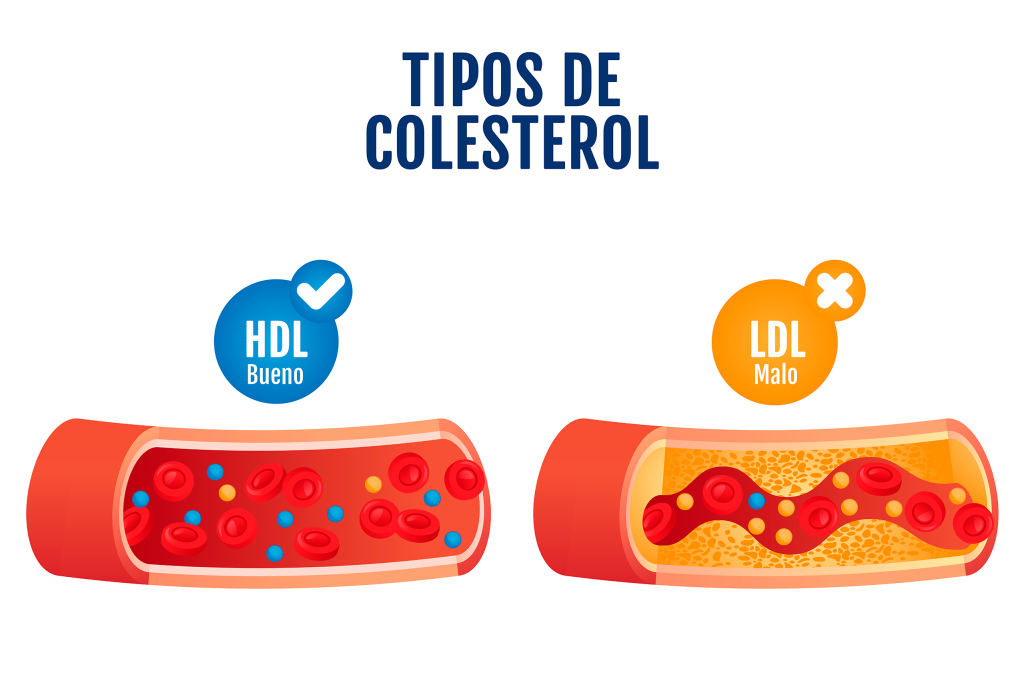 colesterol 250 hombres