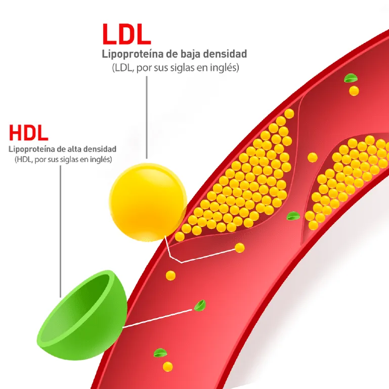 colesterol ldl alto