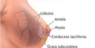 Cancer de mama