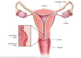 cancer de cuello uterino sintomas