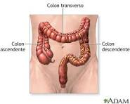 Cancer de colon sintomas